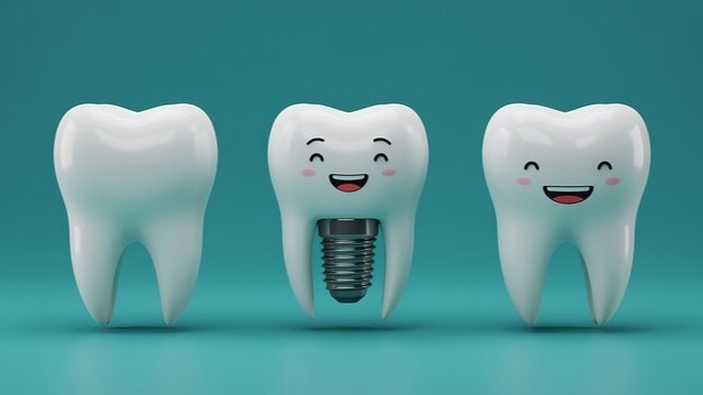 Dental Implant in Pune by Dr. Hileri Mori,personalized dental implant treatment in Pune,dental implant in Pune,Dental Implant Clinic Pune,Dr. Hileri Mori