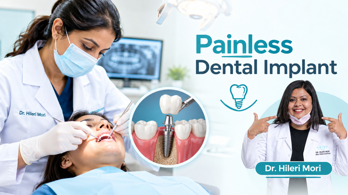 painless dental implant in Pune, dental implants in Pune, Dr. Hileri Mori, dental implant specialist in Pune, missing teeth replacement in Pune, comfortable dental implant procedure, dental implant treatment cost in Pune, advanced dental implant treatment, tooth replacement options in Pune,pain free dental implant